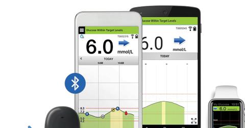 Eversense CGM from Senseonics