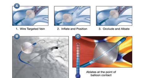 uploads///cryoablation