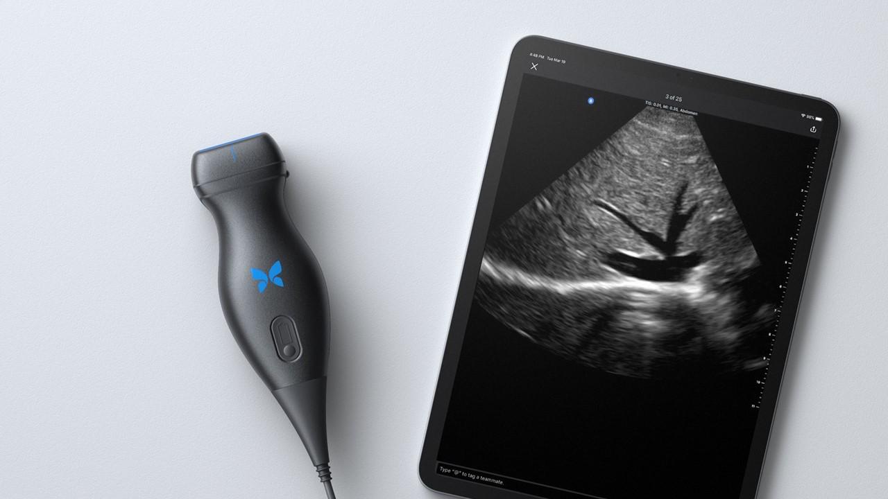 What Is Butterfly Network's (BFLY) Stock Forecast for 2021?