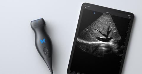 Butterfly Network device