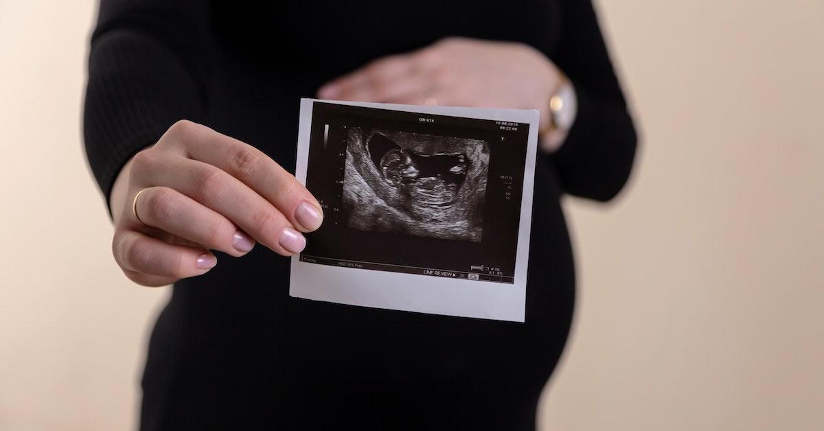 A pregnant woman holding an ultrasound picture