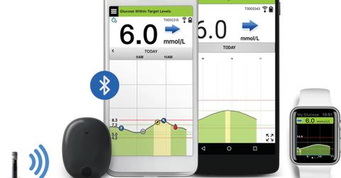 Eversense CGM system