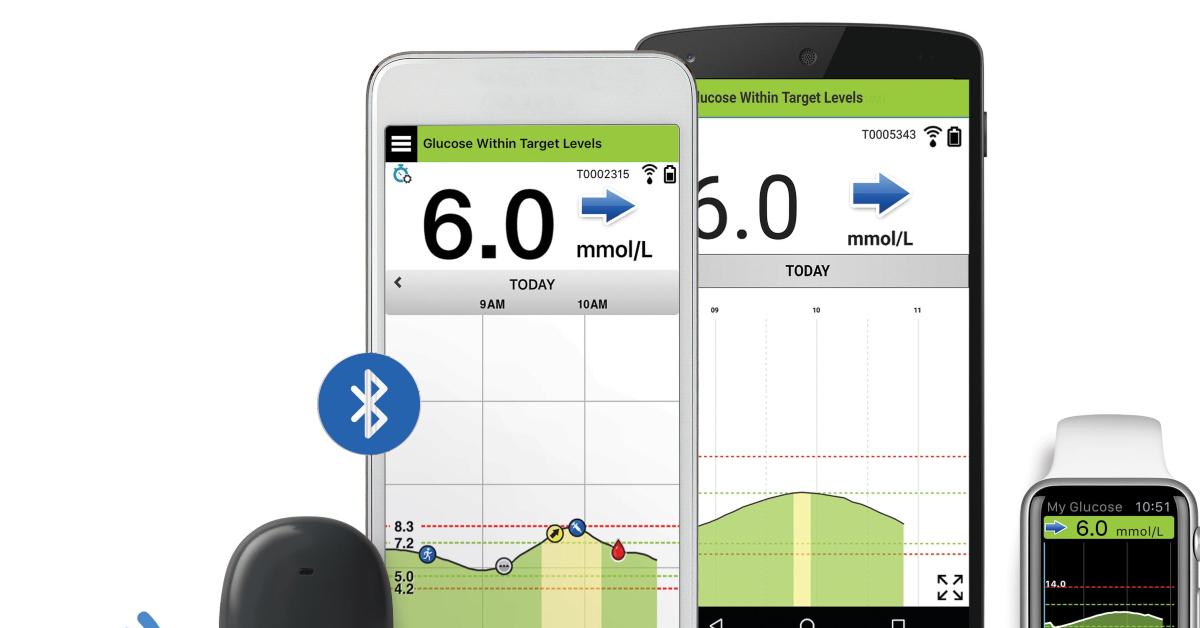 Will SENS Stock Go Back Up and Should You Buy Before FDA Approval?