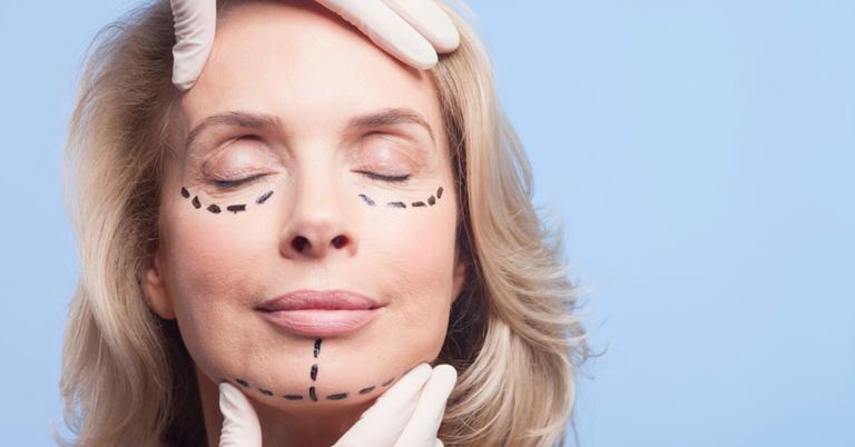 Is Cosmetic Surgery Tax Deductible? These Procedures Can Be Claimed